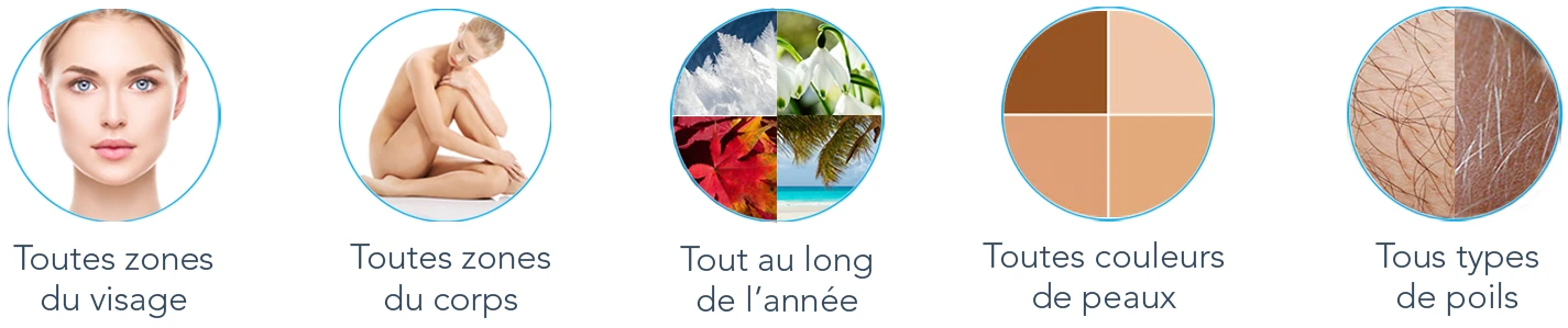 Illustration des possibilités